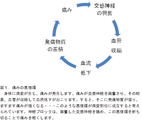 痛みの悪循環の画像